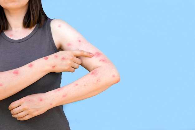 Clonidine rash side effect