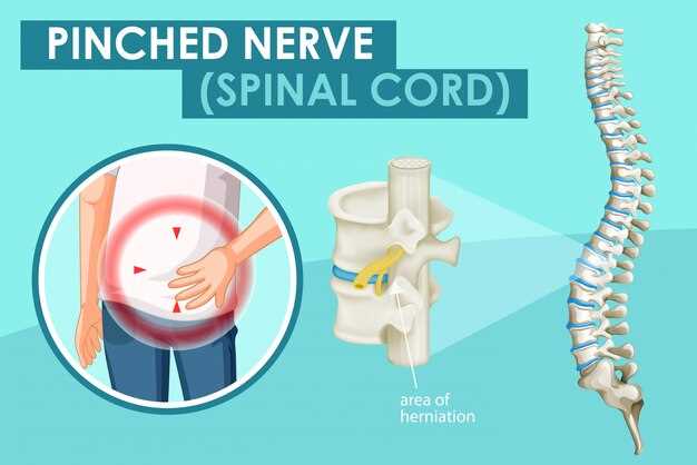 Spinal clonidine